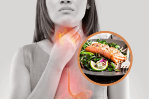 dieta para el reflujo gastroesofágico