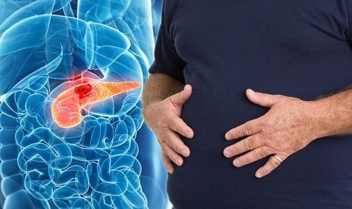 Dieta para pacientes con cáncer de páncreas