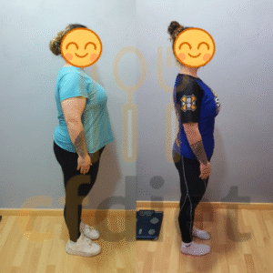 Nutricionista paciente con SIBO IMO y sobrepeso