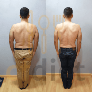 Antes y después de paciente hombre en consulta dietética El Vendrell.