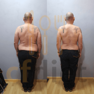 Evolución de pérdida de peso en hombre en consulta de nutrición El Vendrell.